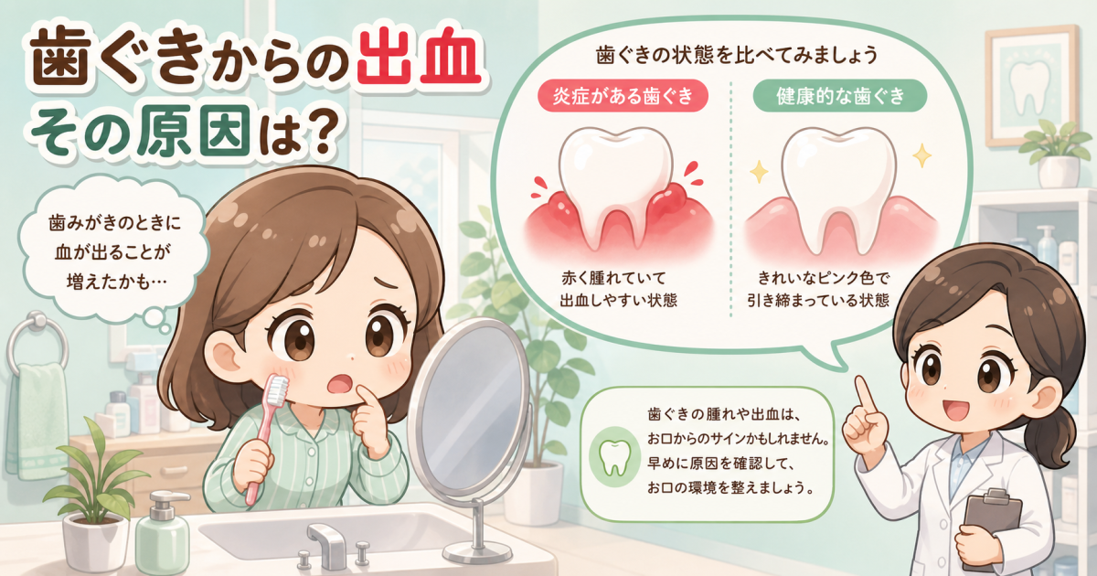 歯みがきで歯ぐきから出血？原因と歯周病の初期症状・受診目安を解説