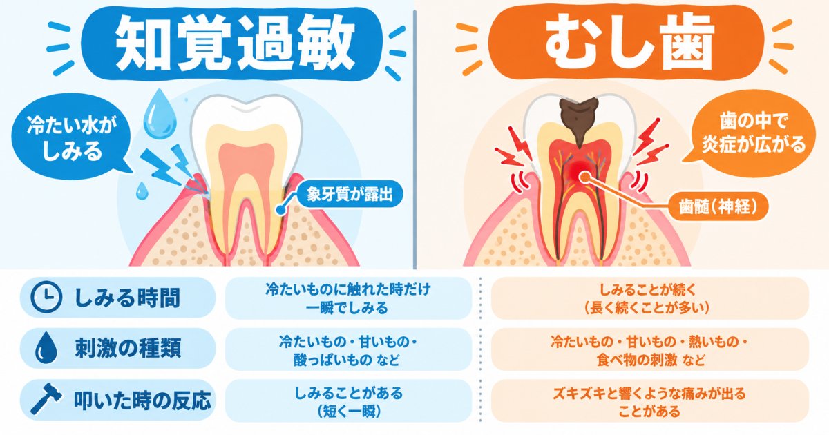歯がしみる原因は知覚過敏？痛みの特徴とむし歯との見分け方