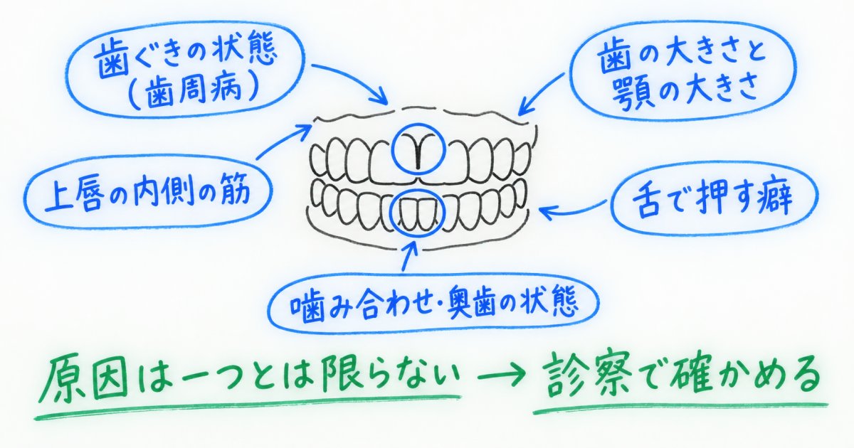 前歯のすき間があき、別の歯が重なるのはなぜ？